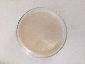 食品微生物检测中的菌落总数问题 基于PowerDiscuz的技术与实践探讨