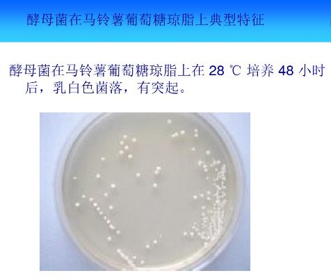 PPT图解丨常见微生物菌落形态与微生物菌剂